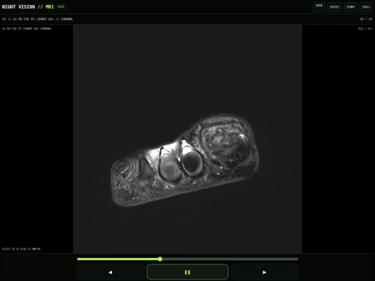 MRI screenshot