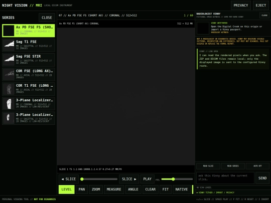 MRI3 screenshot