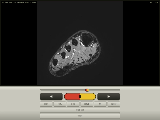 MRI_juice_visualizers screenshot